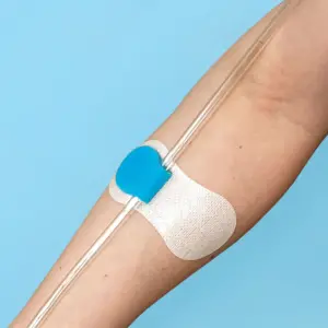 elastoFIXAL